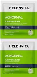 HELENVITA ACNORMAL PEELING GEL ΤΖΕΛ ΑΠΟΛΕΠΙΣΗΣ ΜΕ ΟΞΕΑ ΓΙΑ ΤΗ ΛΙΠΑΡΗ ΜΕ ΤΑΣΗ ΠΡΟΣ ΑΚΜΗ ΕΠΙΔΕΡΜΙΔΑ 16ML (2X8ML) ΦΑΡΜΕΞ