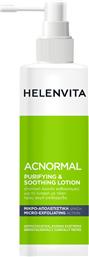 HELENVITA ACNORMAL PURIFYING & SOOTHING LOTION FOR OILY SKIN ΣΤΥΠΤΙΚΗ ΛΟΣΙΟΝ ΚΑΘΑΡΙΣΜΟΥ ΓΙΑ ΛΙΠΑΡΗ ΜΕ ΤΑΣΗ ΠΡΟΣ ΑΚΜΗ ΕΠΙΔΕΡΜΙΔΑ 200ML ΦΑΡΜΕΞ