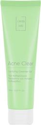 ACNE CLEAR CLARIFYING CLEANSER GEL ΚΑΘΑΡΙΣΤΙΚΟ ΤΖΕΛ ΠΡΟΣΩΠΟΥ ΓΙΑ ΛΙΠΑΡΕΣ ΕΠΙΔΕΡΜΙΔΕΣ 150ML LAVISH CARE