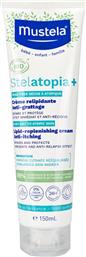 STELATOPIA+ LIPID-REPLENISHING CREAM ANTI-ITCHING ΜΑΛΑΚΤΙΚΗ ΚΡΕΜΑ ΣΩΜΑΤΟΣ ΚΑΤΑ ΤΟΥ ΚΝΗΣΜΟΥ ΓΙΑ ΕΞΑΙΡΕΤΙΚΑ ΞΗΡΟ, ΑΤΟΠΙΚΟ ΔΕΡΜΑ 150ML MUSTELA