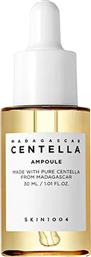 MADAGASCAR CENTELLA AMPOULE ΚΑΤΑΠΡΑΥΝΤΙΚΟΣ ΟΡΟΣ ΠΟΥ ΒΟΗΘΑ ΣΤΗΝ ΗΡΕΜΙΑ & ΣΤΗΝ ΑΠΟΚΑΤΑΣΤΑΣΗ ΤΗΣ ΙΣΟΡΡΟΠΙΑΣ ΣΤΟ ΔΕΡΜΑ 30ML SKIN1004